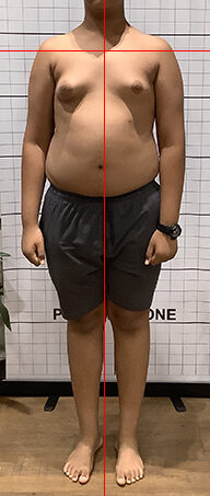 After therapy posture