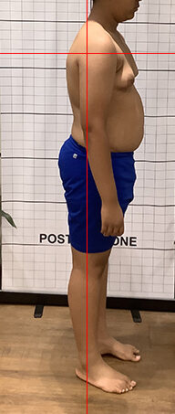 Before therapy side view