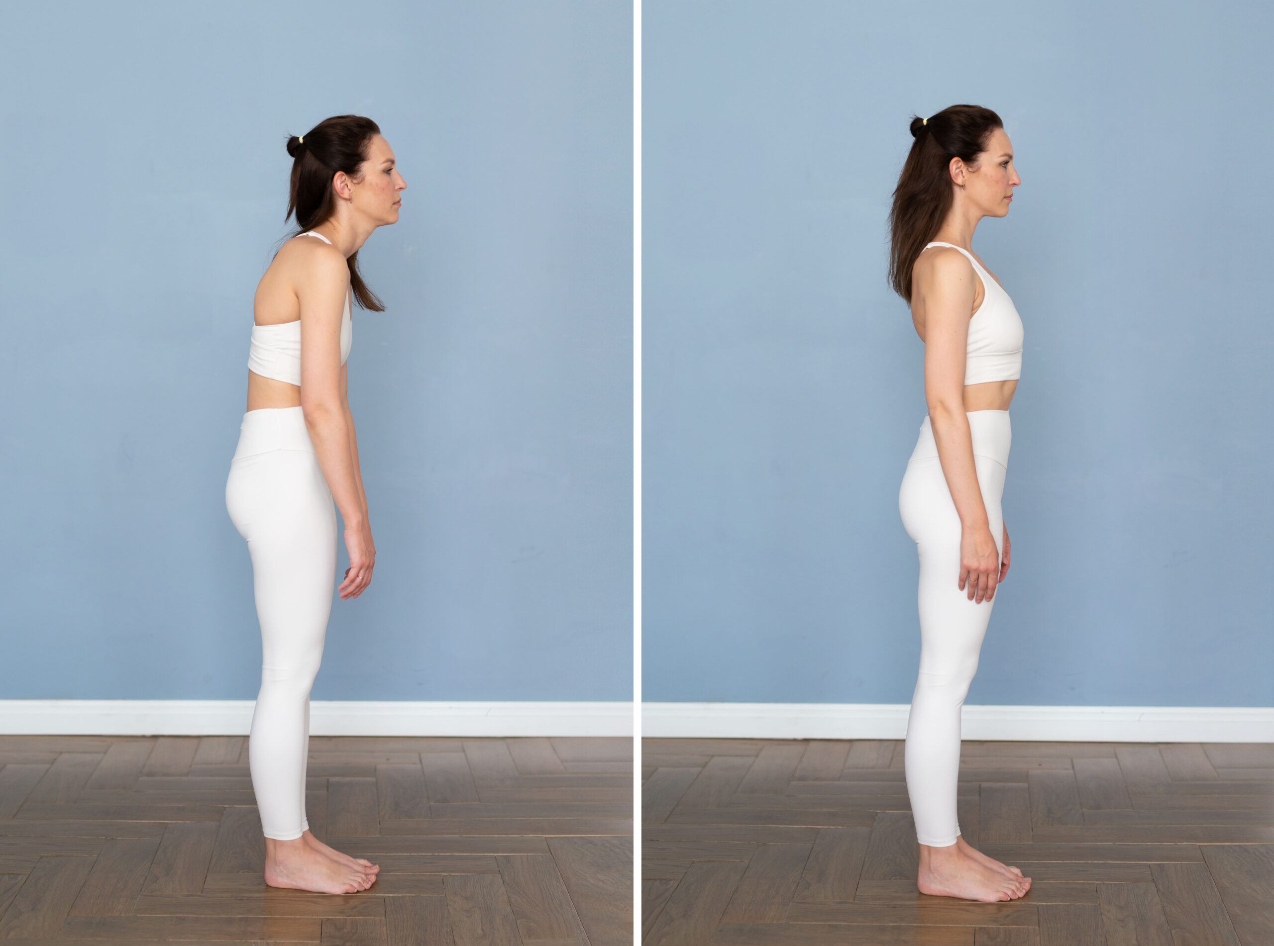 posture-problems-spinal-curvature-scoliosis-correct-posture (1)